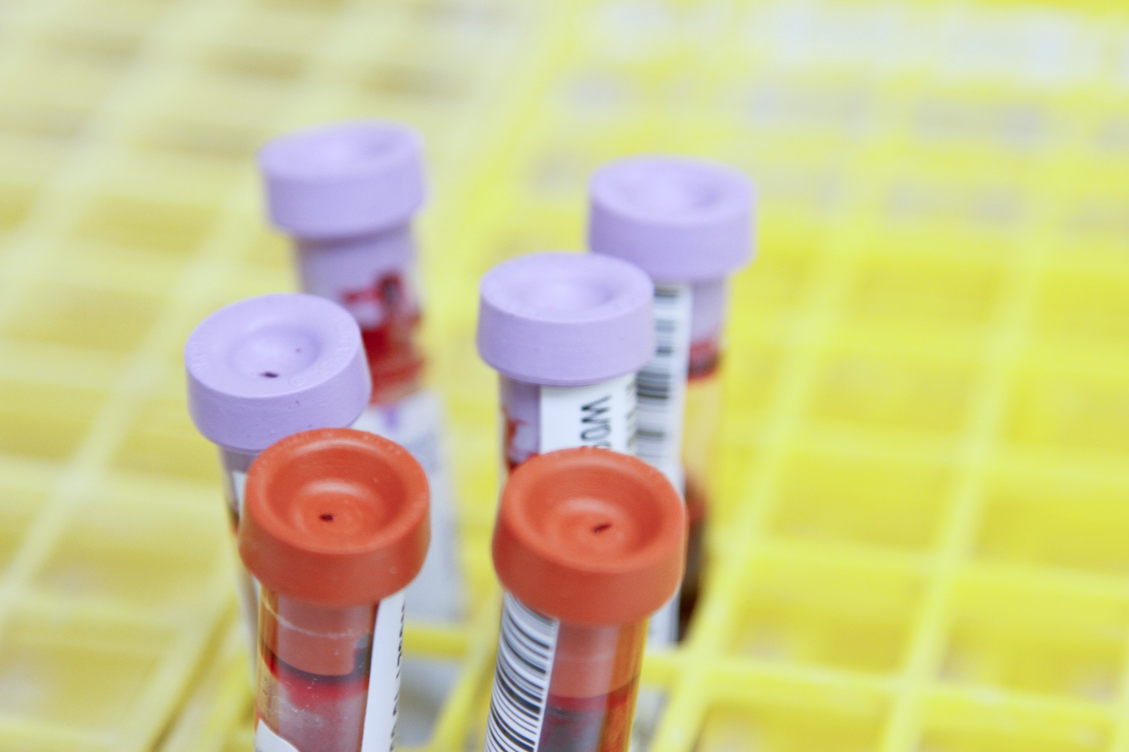 I Had A False Positive HIV Test While Pregnant